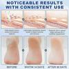 Urea & Salicylic Acid Foot Stick for Dry Cracked Heels, Hands, Knees - 60% Urea + 2% Acid Callus Remover