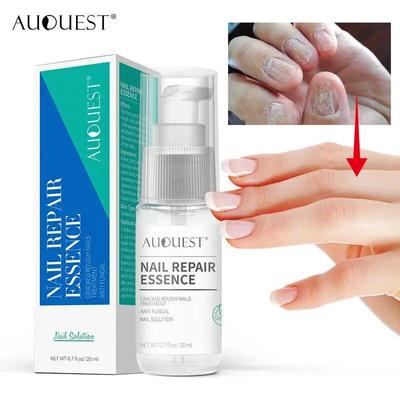 Sérum pro ošetření nehtů Esence pro péči o nohy Bělení nohou Odstranění nehtů na nohou Odstranění nehtů Opravný gel 20 ml