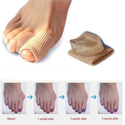 Zehentrenner, 1 Stück, Knochen-Daumen-Glätteisen, Ballenschutz-Stretcher