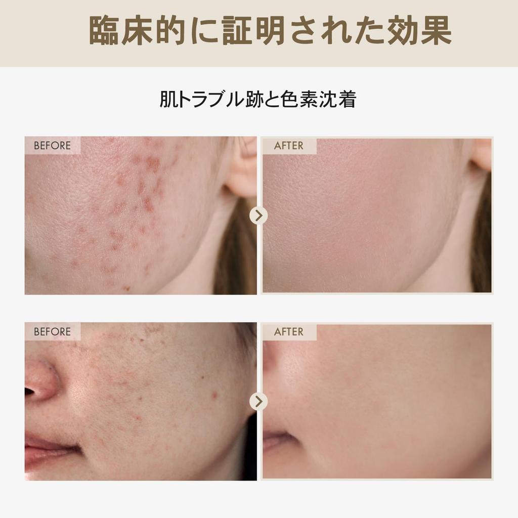 TOSOWOONG Alpha Arbutin 2 Rice Alpha Skin Age Spot Korean Skincare Cosmetics Serum, 33ml, Rice, 746,074 ppm, Arbutin, 20,000 ppm, Glow, Tone,