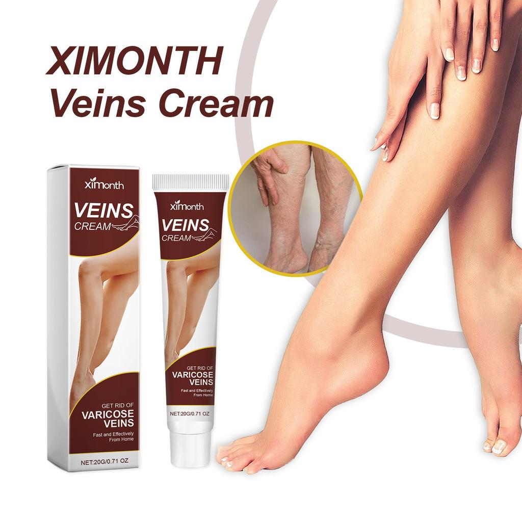 Vein Care Fading Paste -Anti Varicose Vein Soothing Leg Paste,  The Appearance Of Varicose Veins