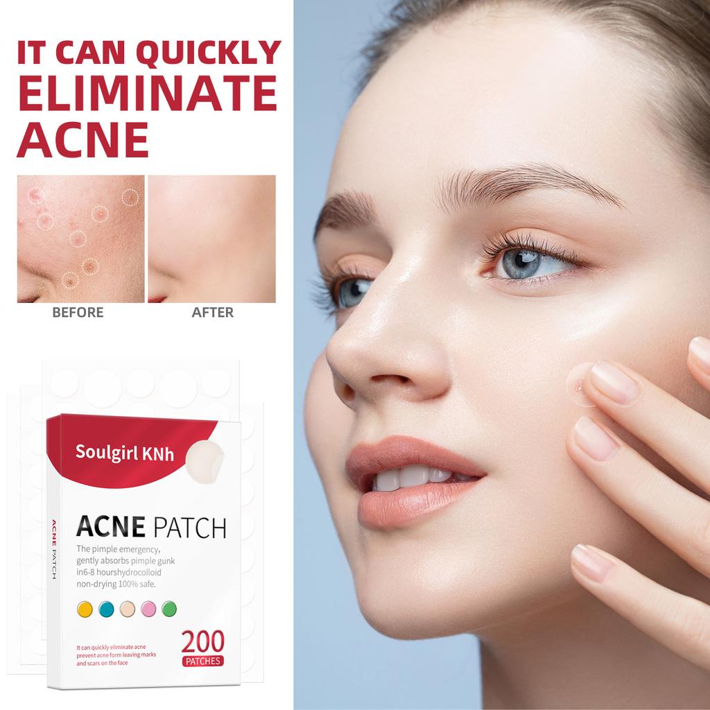 Youth Acne Patch Acne Portable Fade Spots Acne Clean Closed