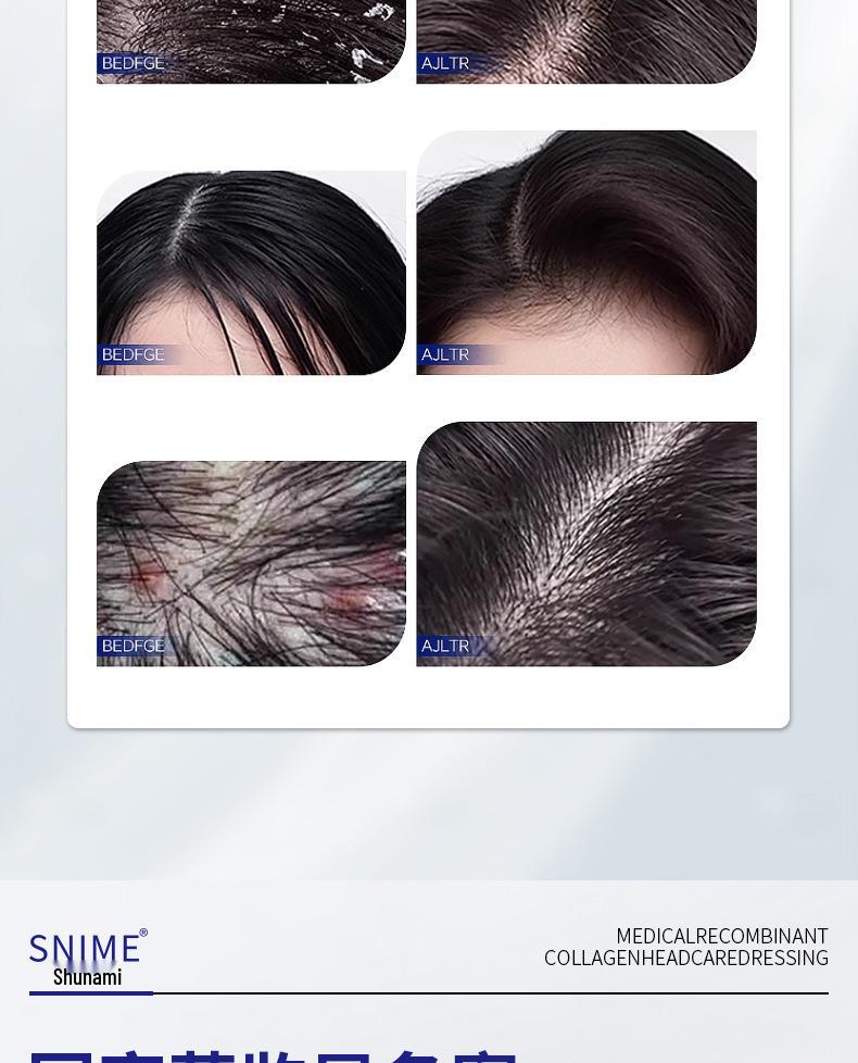 CVKK Medical Collagen Anti-Dandruff & Itch Relief Shampoo for Seborrheic Dermatitis.