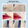 Pulsed Light Epilator with Freezing Function 500,000 Flashes IPL Laser Hair Removal Hair Removal Care for Underarms Body