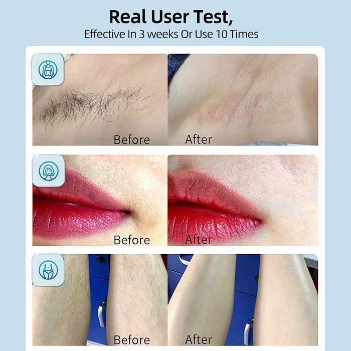 Pulsed Light Epilator with Freezing Function 500,000 Flashes IPL Laser Hair Removal Hair Removal Care for Underarms Body