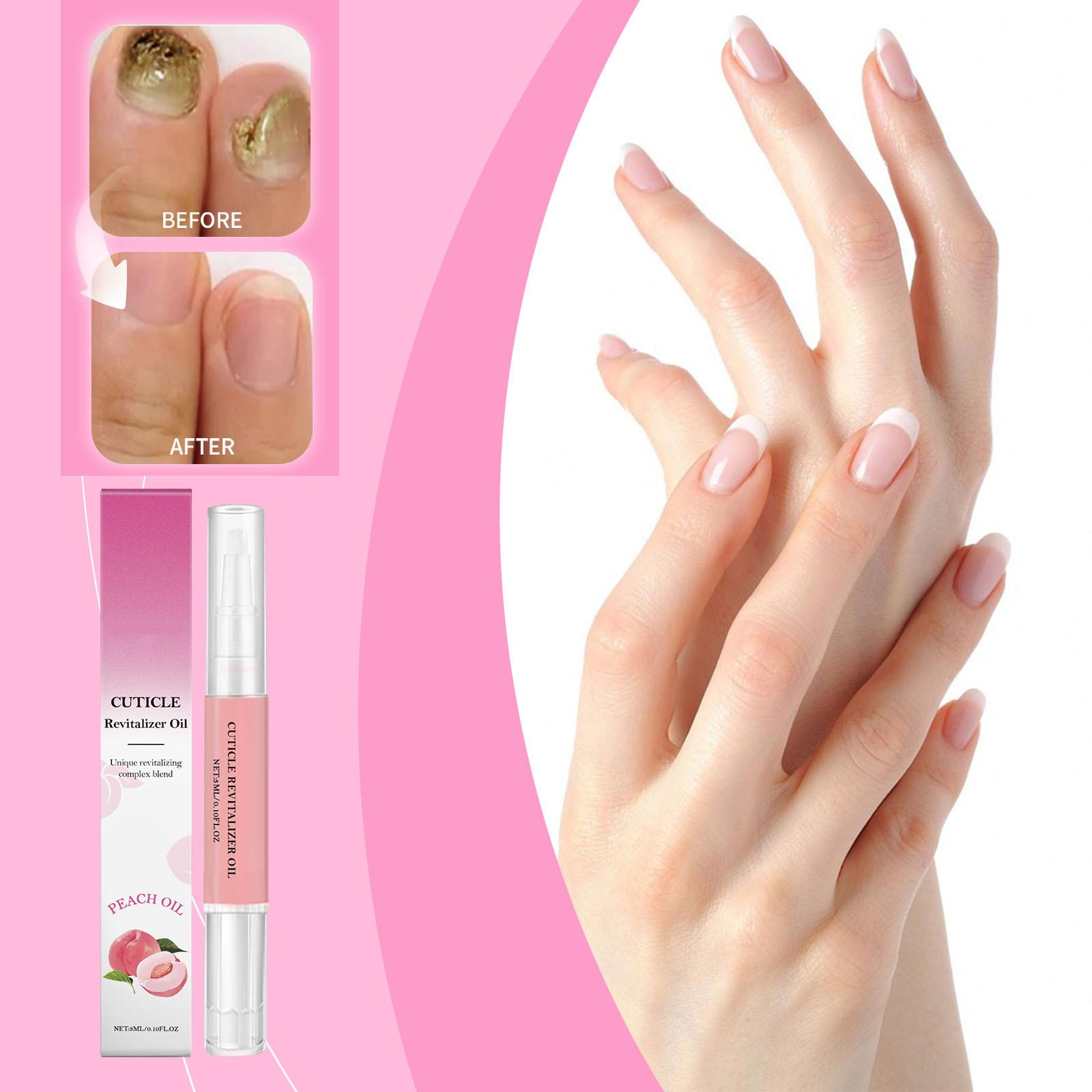 

Питательный и растрескивающийся лак для ногтей, прочная поверхность ногтей, уменьшает ломкость, стойкий, блестящий, мягкий и не повреждает ногти, подходит для ежедневного использования.3 мл One Size белый