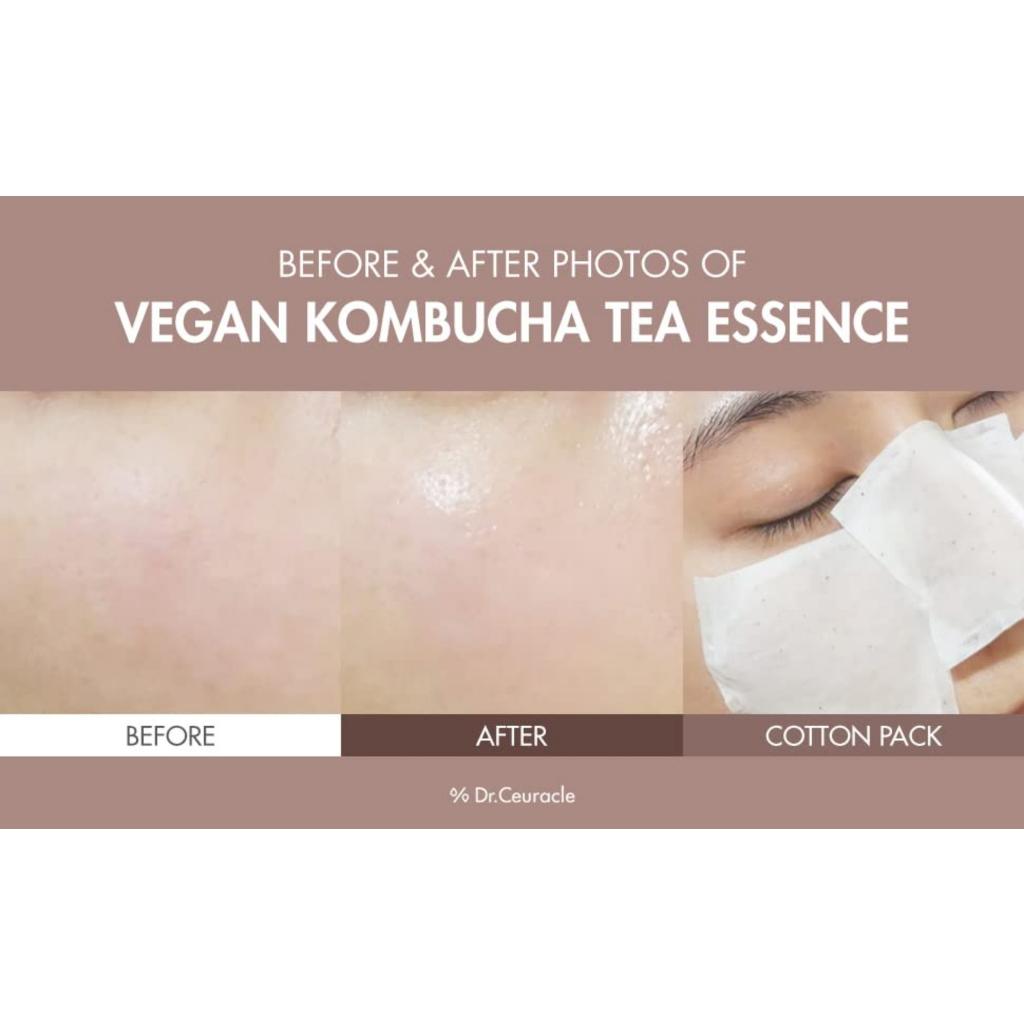 DR.CEURACLE Vegan Kombucha Tea Essence 150ml