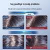 Vithair Selenium Sulfide Anti-Dandruff Shampoo