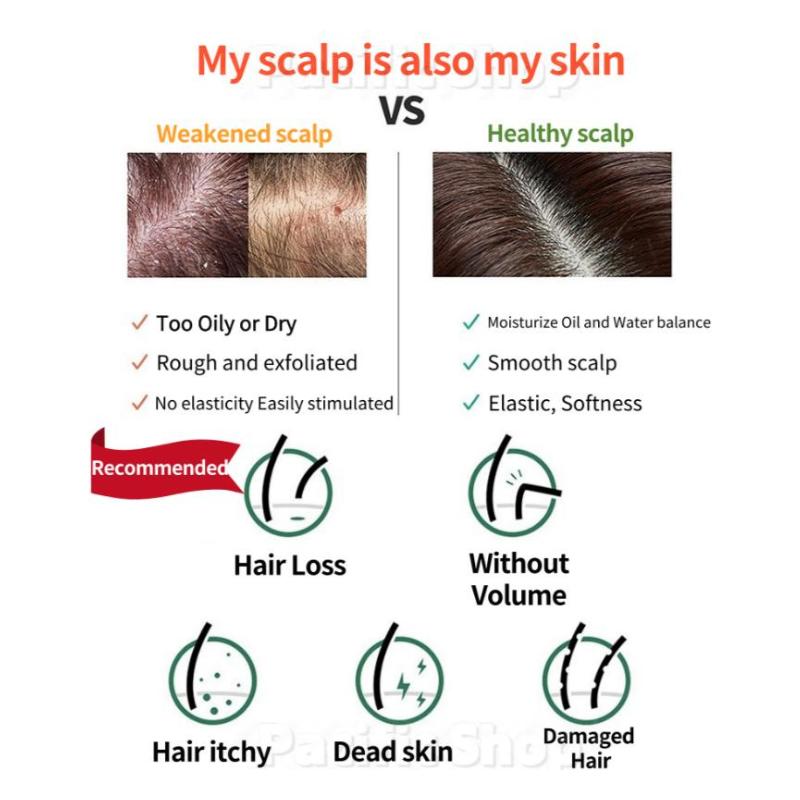 LABO-H Probiotics Scalp Skin Care Scalp Hairloss Care Straightening Shampoo 112ml X 3Ea ( 336ml / 11.36 Fl Oz)