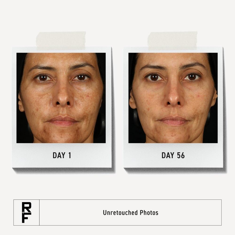 Rodan + Fields Multi Acid Enzyme Peel Dark Spot Corrector + Exfoliator 1 Oz