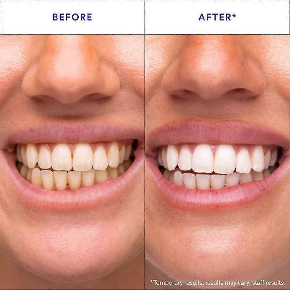 V34 Purple Whitening Teeth Strips Whitens After One Use, Whitening and Colour Correction, Gentle Formula Enamel Protection