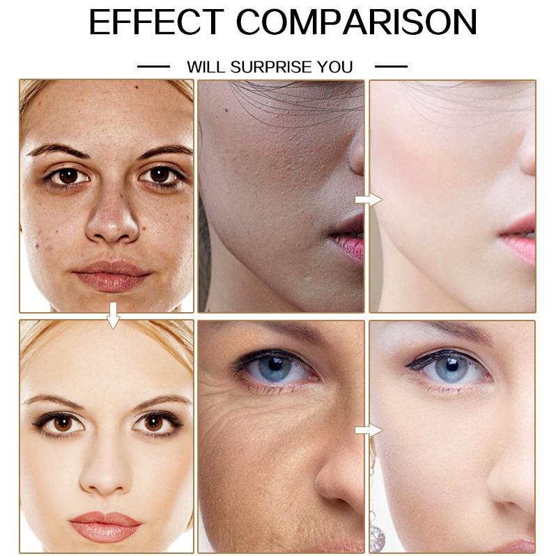 Oligopeptide Chamomile Serum Moistening Whitening Essence Anti Wrinkle Blemish Face Care