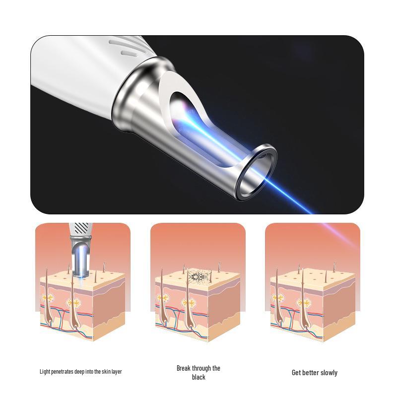 Ultra Picosecond Freckle & Mole Laser Removal Machine: Portable All-in-One Home & Salon Use