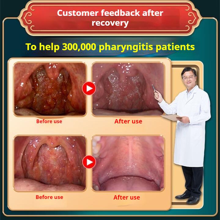 Plasture pentru faringită cronică faringită faringită plasture plat pentru acupunctură plasture pentru magnetoterapie