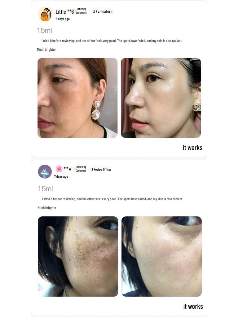 Han Bei Dan White Oil - Whitening & Freckle Removal Essence