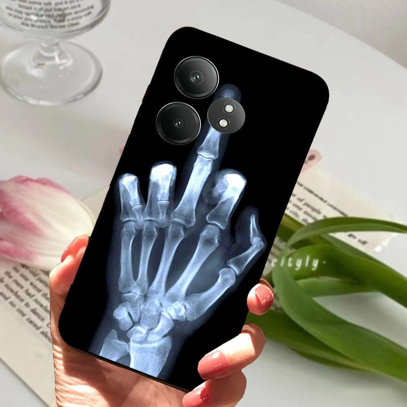 For Realme GT 6 GT6 Case Shockproof Soft TPU Silicone Phone Cover For Realme GT 6T Capa Realme GT6 GT6T Cartoon Matte Bumper