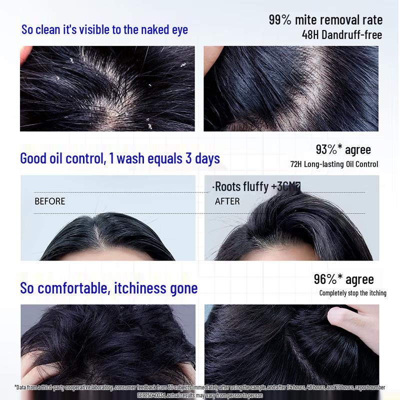 Ocean Supreme Men's Scalp Care Anti-Dandruff Oil Control Shampoo 500g