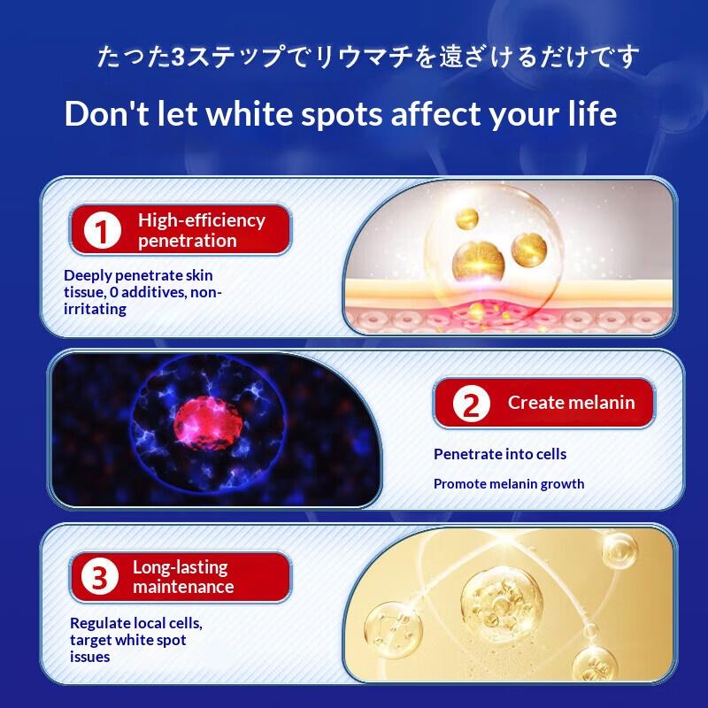 Cream for Uneven Skin Tone: Works To Restore Skin Affected by Vitiligo