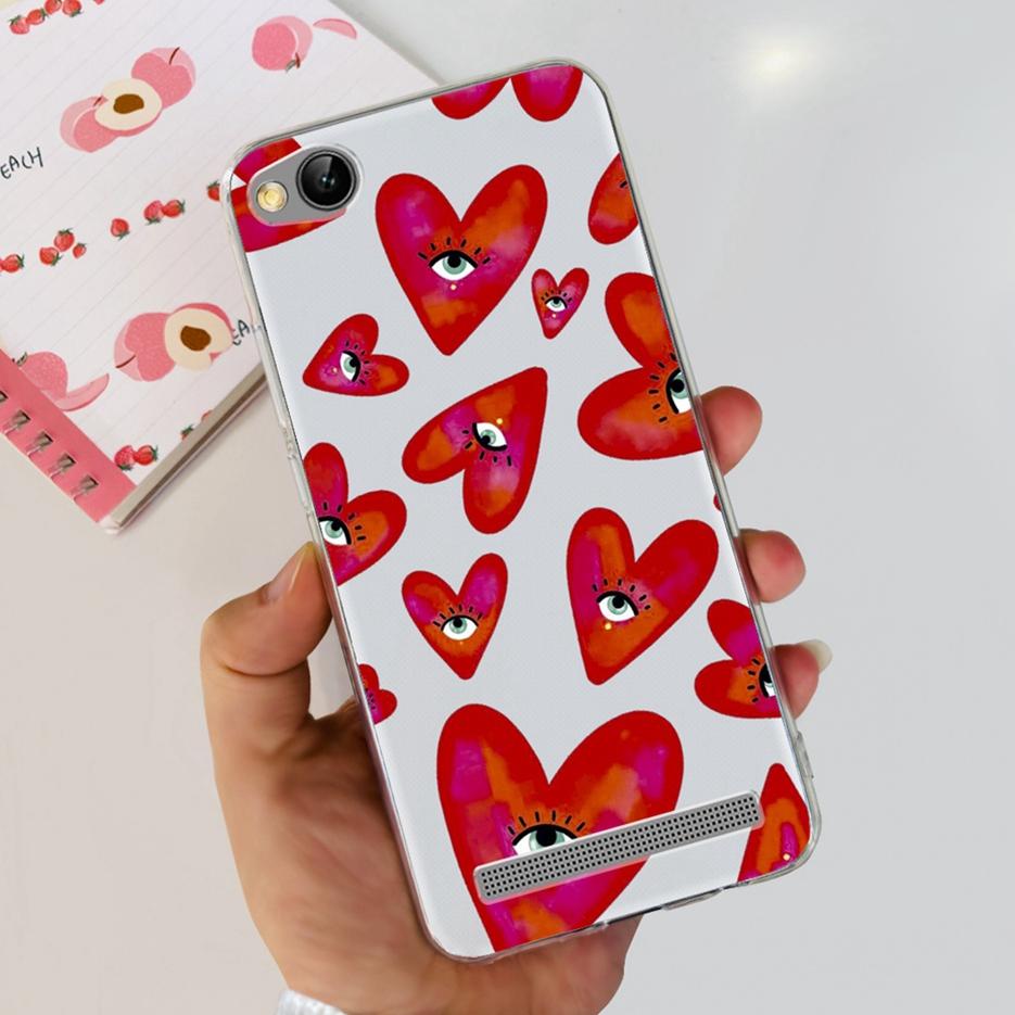 For Xiaomi Redmi 5A Case Redmi 4A Stylish Painted Cover Soft Slim Phone Case For Xiaomi Redmi 4A 5A Redmi5A Back Cover TPU Funda