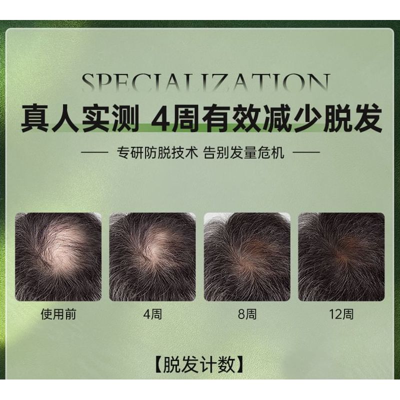 ZOOLY - No. 9 Anti Hair Loss Scalp Care Essence