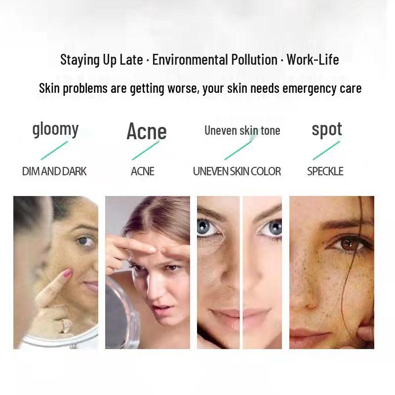 Tranexamic Acid Brightening Face Cream for Melasma, Age Spots, Freckles, and Dark Spot Correction