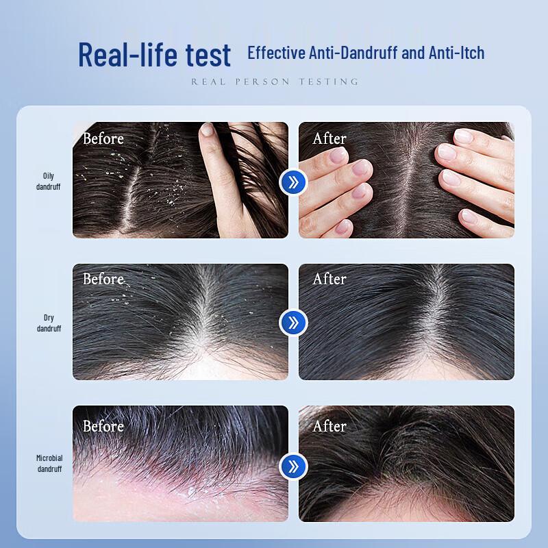 Vetes Origin Care Oil Control Anti-Dandruff Shampoo