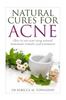 The Natural Cures for Acne : How To Cure Acne Using Natural Homemade Remedies and Treatments : 1 Book