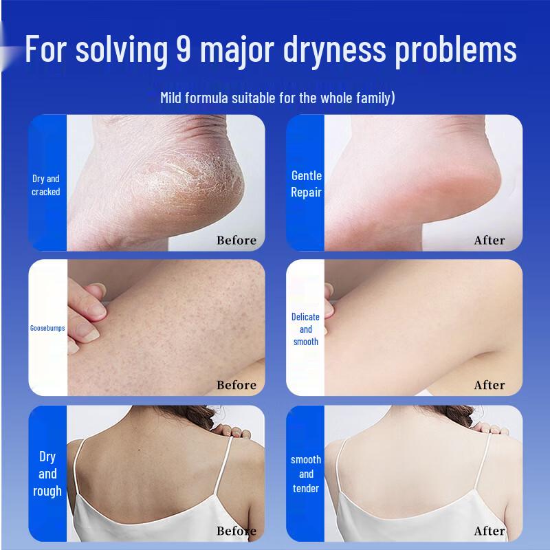 YALOIS Urea Repair & Moisturizing Cream