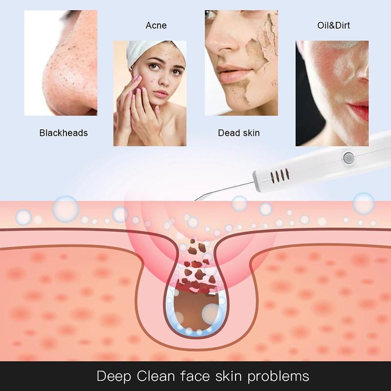 Face Acne Spots Removal Skin Scrubber Beauty Lifting Massager Face Cleaning Beauty Tool Facial Ultrasonic Cleaner