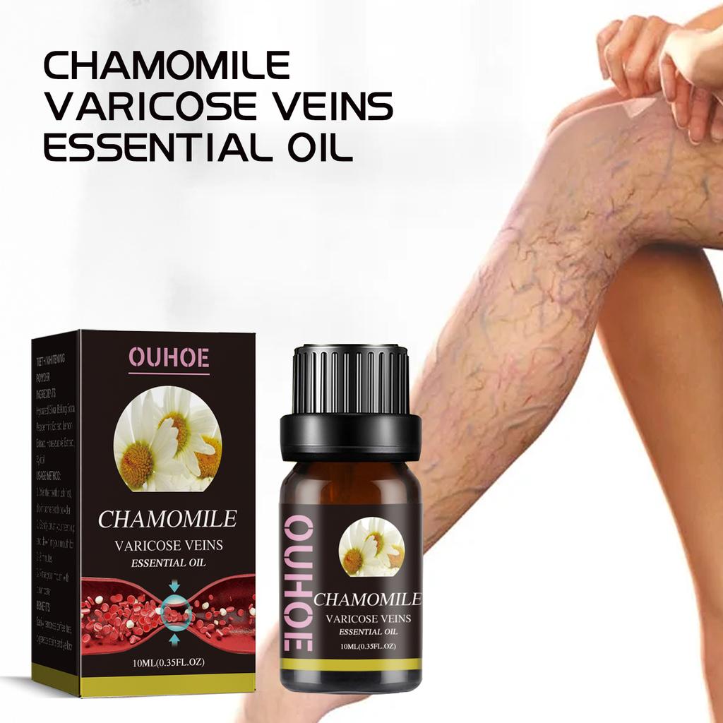 OUHOE Chamomile Essential Oil for Varicose Veins 10ml