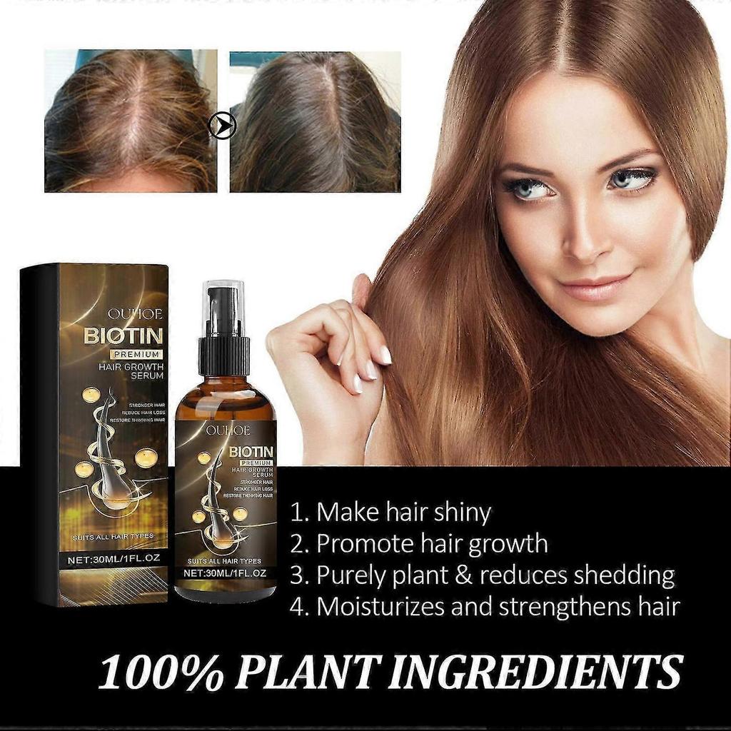 Biotin Hair Growth Serum Spray, Biotin Hair Regrowth Topical Solution Anti Hair Loss Treatment Hair 