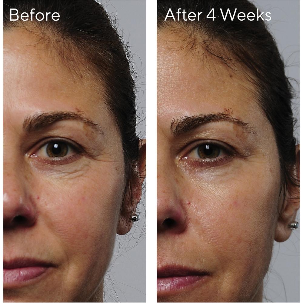 Murad Rapid Collagen Infusion Instant Plumping Treatment 1.0 Oz