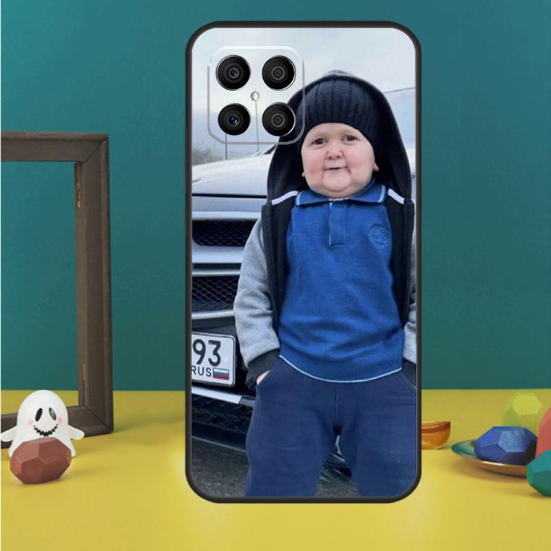 Funny Hasbulla Case For Honor X9c X8a X8b X9b X9a X8 X9 50 70 90 Lite Honor 200 Pro Magic 5 6 7 Lire Cover