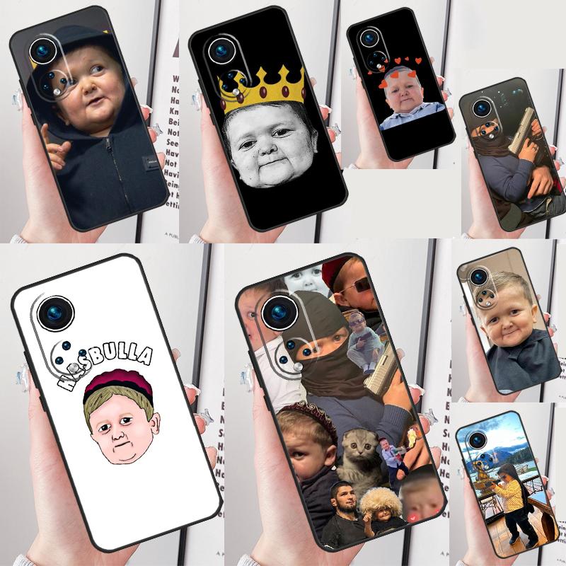 Funny Hasbulla Case For Honor Magic 7 5 6 Lite Honor 200 Pro X8b X9a X8a X8 X9 X9c X9b 50 70 90 Lite Cover