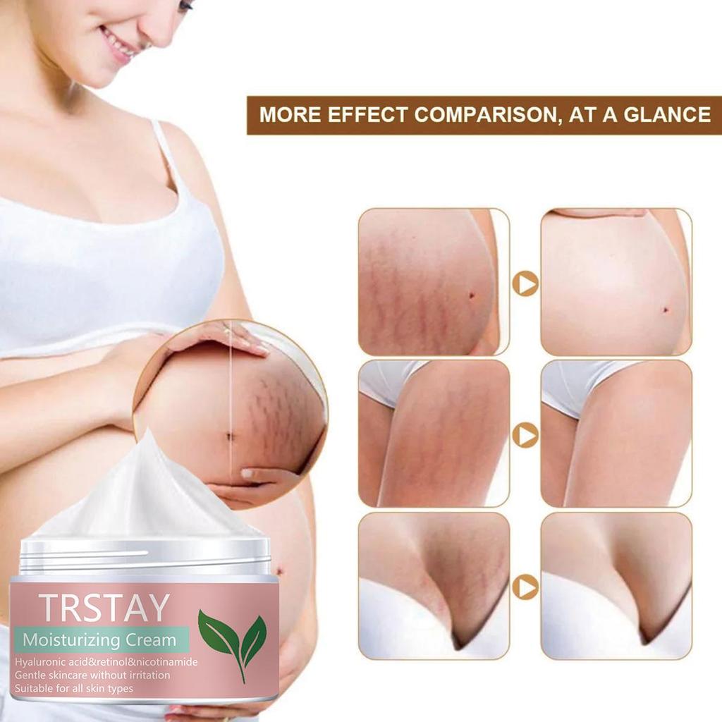 Gentle and Non-irritating, the Smoothing Skin Stretch Mark Cream Smooths Wrinkles, Fades Fine Lines, and Leaves Skin Soft and Refined