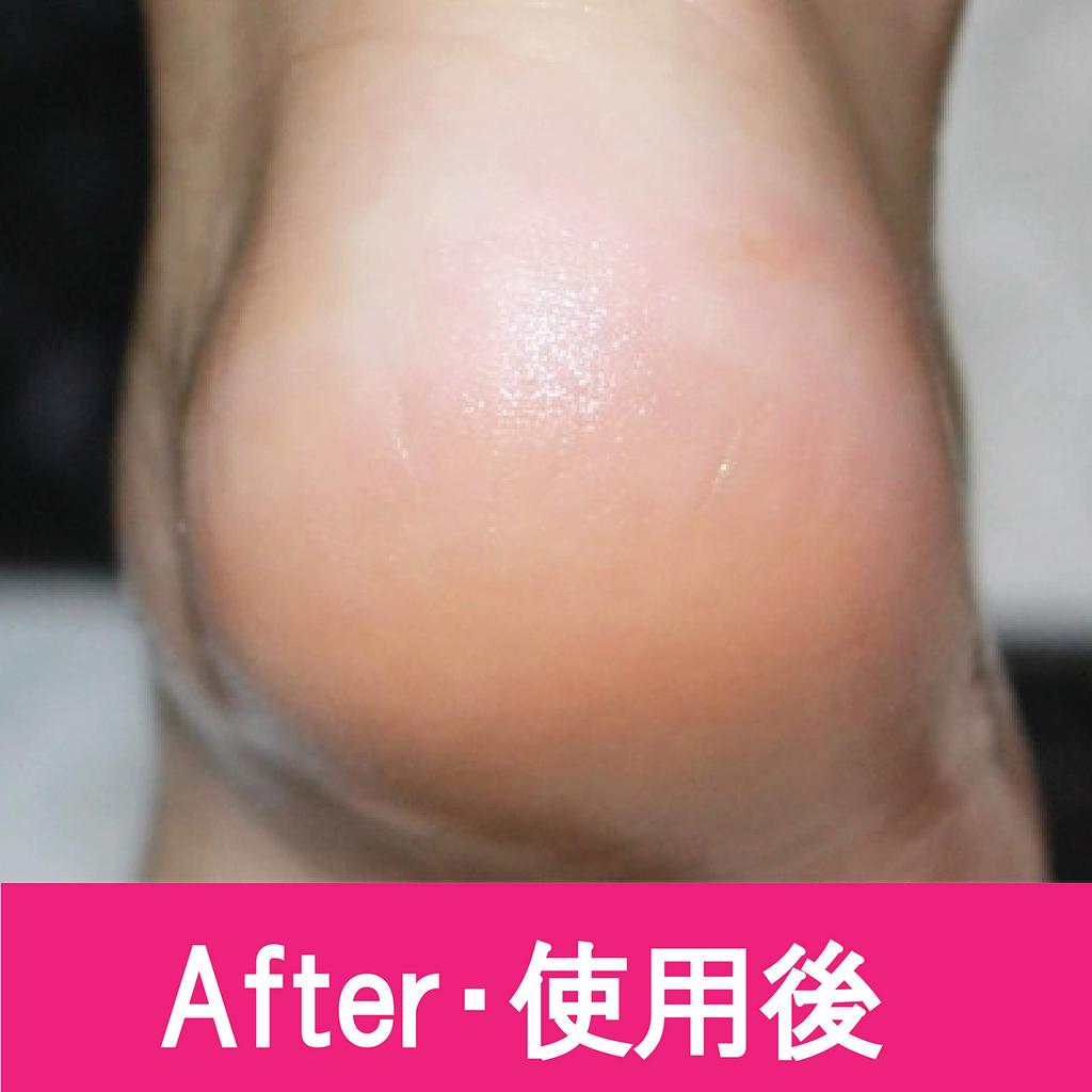 PERFECT NAILS Powerful Foot Heel Bathtime Tool Men's File, Waterproof, Exfoliating, Care, (Red)