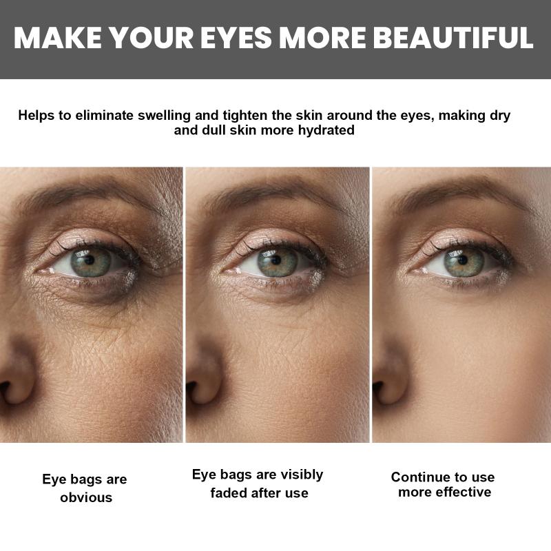 Anti Wrinkle Eye Cream Anti Dark Circles Remove Eye Bags Tightening Firming Hyaluronic Acid Cream Roller Massager Eye Care 20G