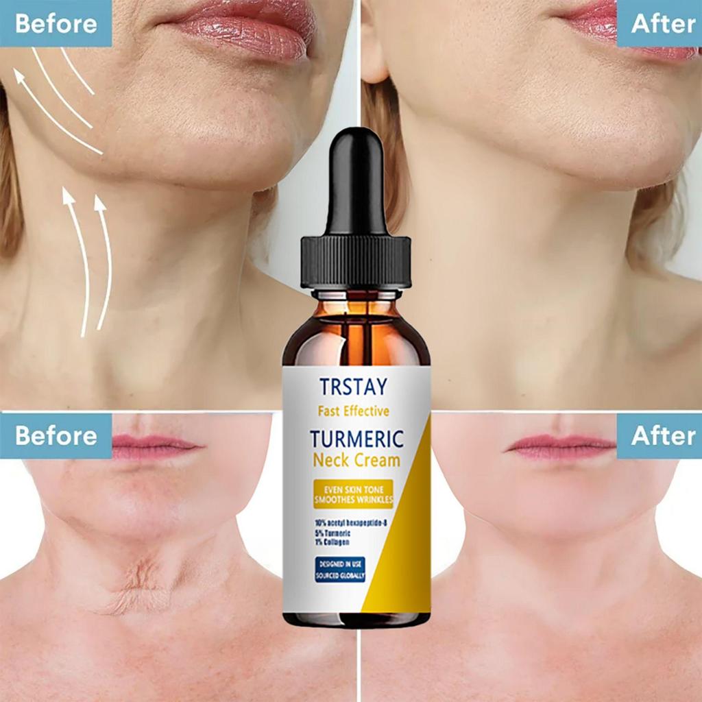 Cream for Neck Skin Care  Face Creams for Women Skin Whitening Cream  Crema Para Manchas De La Cara