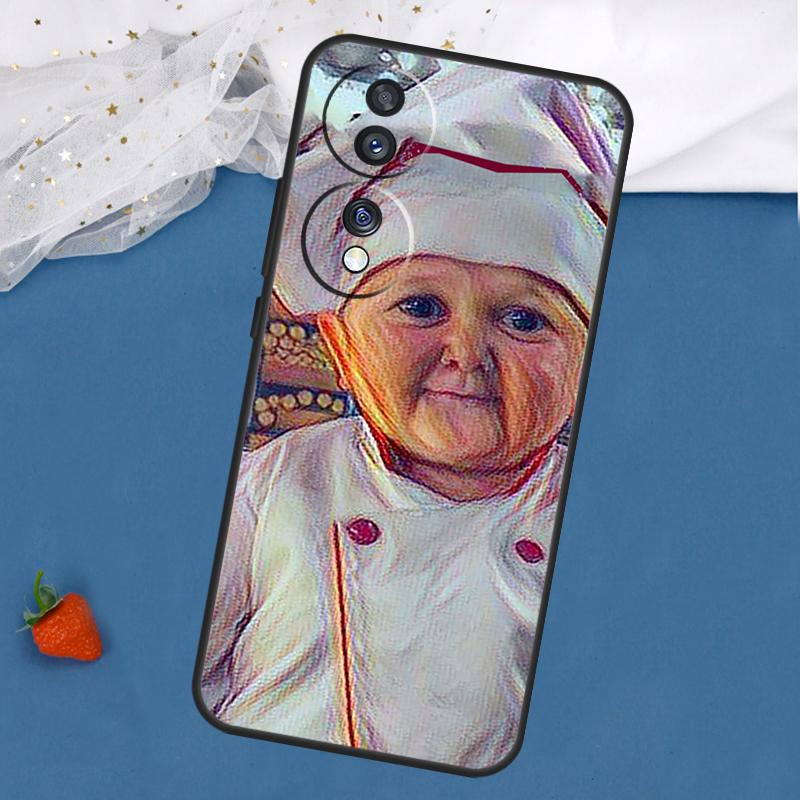 Funny Hasbulla Case For Honor Magic 7 5 6 Lite 8 Pro 200 400 50 70 90 X8c X8b X9a X9b X9c X9d Win RT Cover