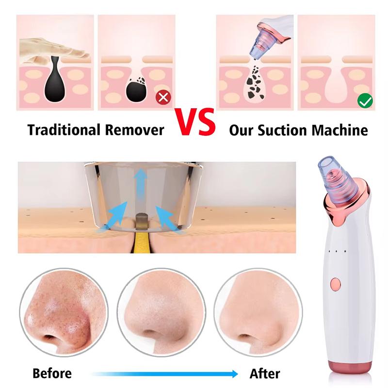 Multi-Functional Cleaning Blackhead Remover Pore Acne Pimple Removal Face T Zone Nose Cleaner Vacuum Suction Facial Beauty Devi