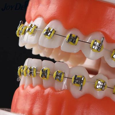 Dental Orthodontic Teeth Model With Metal Braces  School Teaching Equipment