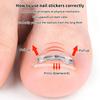 2Pcs Nail Correction Stickers Elastic Ingrown Toenail Corrector Patches Invisible Auxiliary Patch Paronychia Treatment Recover