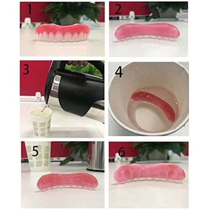 Denture cosmétique - Smile Veneers - Correction des dents - Technologie flexible - Couleur rose - Mixte
