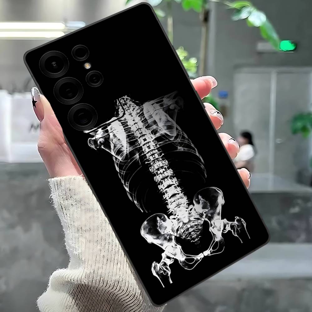 

Radiological Human Organs Skeleton Phone Case For Samsung S 24 Fe 25 Ultra Plus 20 Lite 21 30 22 23 24 22 Ultra 5G Fundas Samsung S30 Ultra 5G