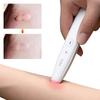 Electronic Anti Itch Pen Rechargeable Insect Bite Relieve Itching Pen After Bite Itch Away Pen for Mosquito Bite Summer Outdoor