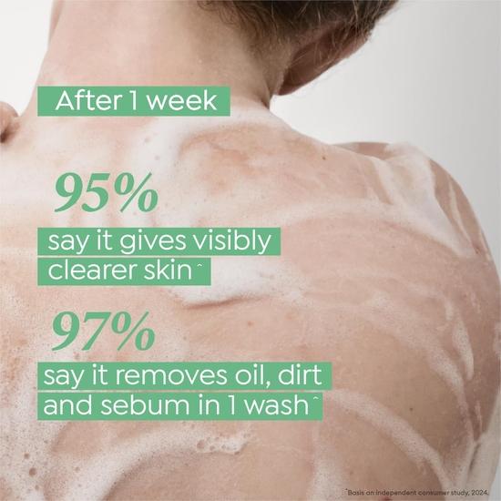 DOVE Acne Clear Serum Body Wash|1% Salicylic Acid Formula| Clears and Helps Prevent Acne | Paraben & SLS Free | 300 Ml