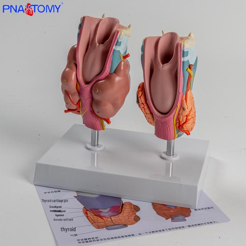 Thyroid Pathology Model: Hyperthyroidism & Hypothyroidism Teaching Aid