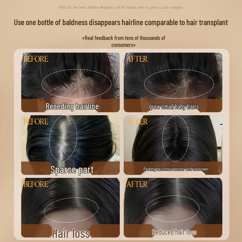 Fanyongchen Ginger Anti-Hair Loss & Volumizing Shampoo