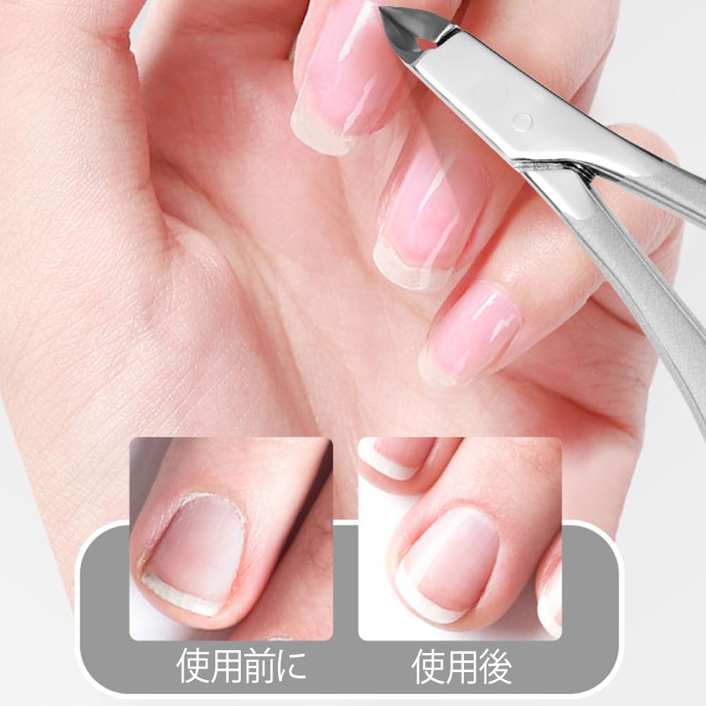 Nail for ingrown hangnail ideal for stainless clippers, nippers, toenails, trimmers, non-slip, thick/deformed/ingrown nails, high-hardness steel.