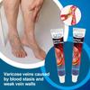 Anti-swelling Cream Foot Pain Cream Legs